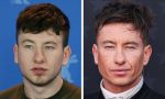 Barry Keoghan Plastic surgery speculation.